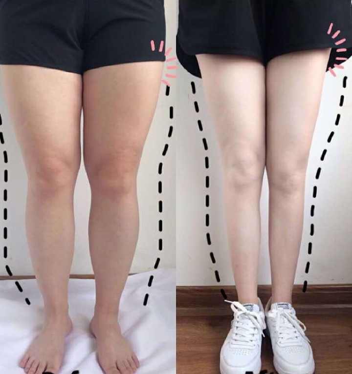 체중 관리 노력